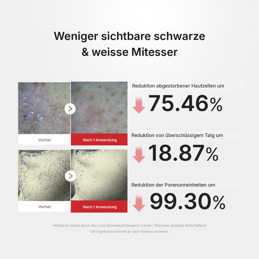 Hypochlorsäure Reis Peel Shot