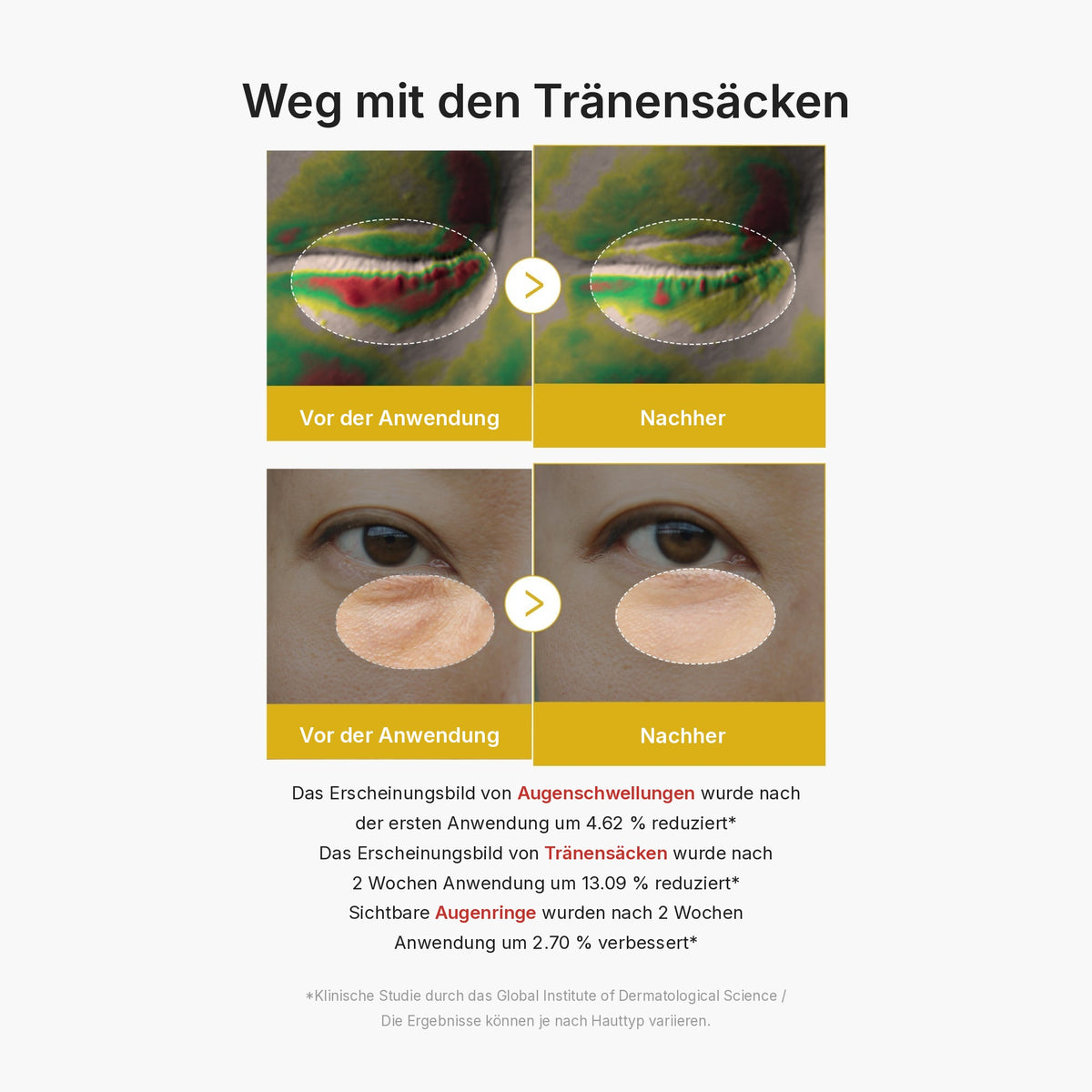 Kojisäure Kurkuma Augen-Gelserum
