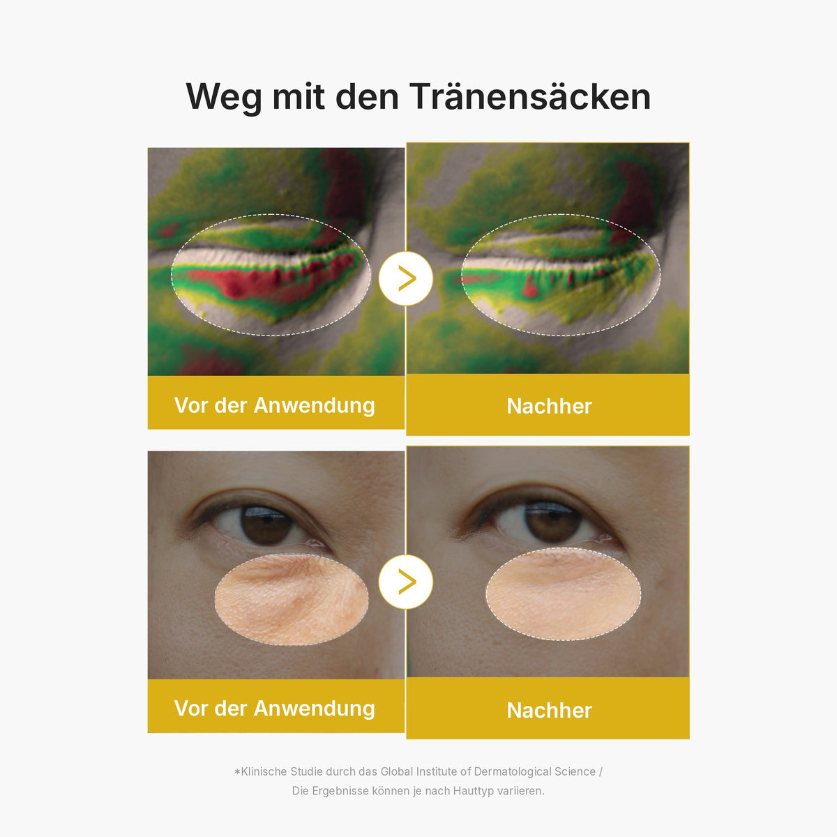 Kojisäure Kurkuma Augen-Gelserum