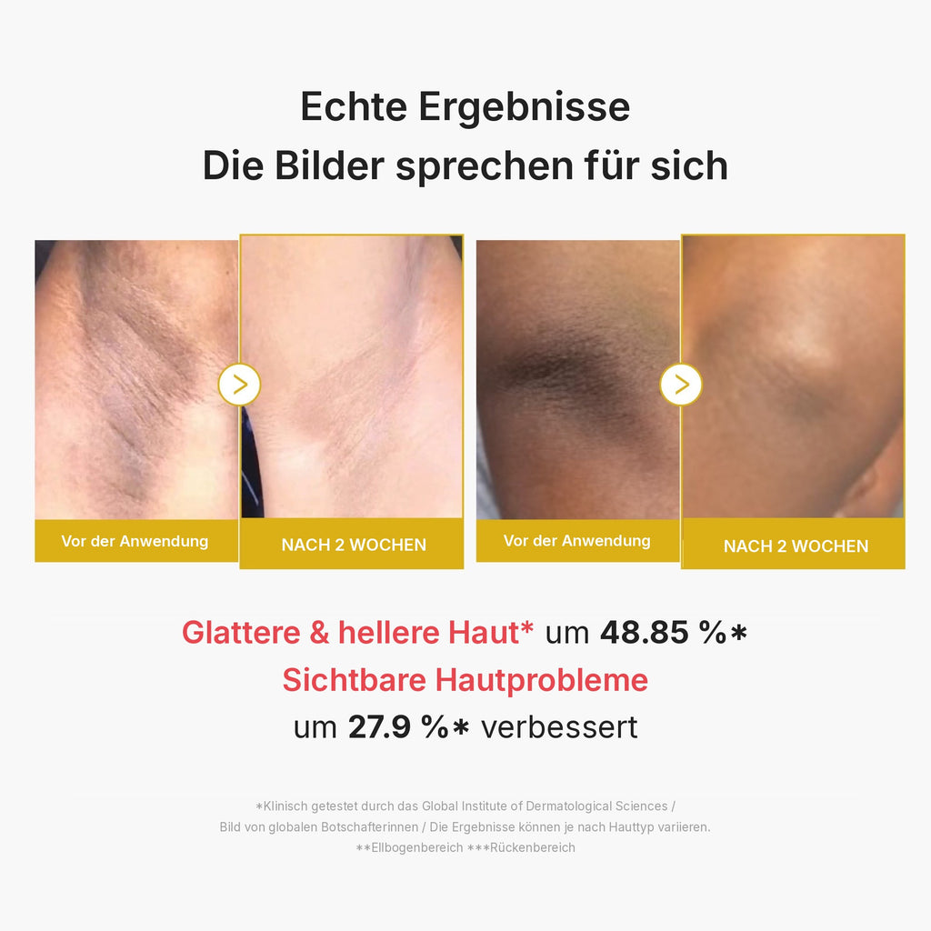 Kojisäure Kurkuma Body Peel Shot