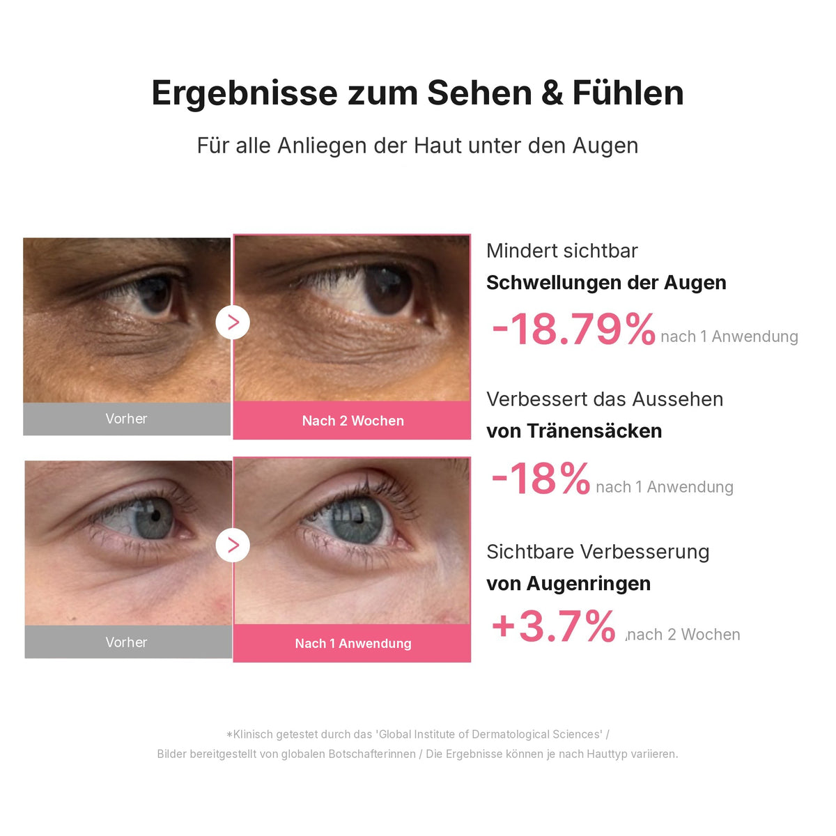 PDRN Koffein Collagen Augenpatches