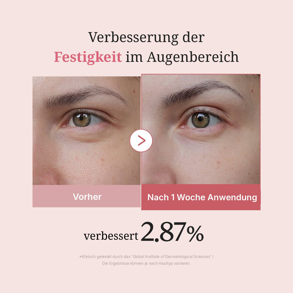 PDRN Pink Peptid Augencreme
