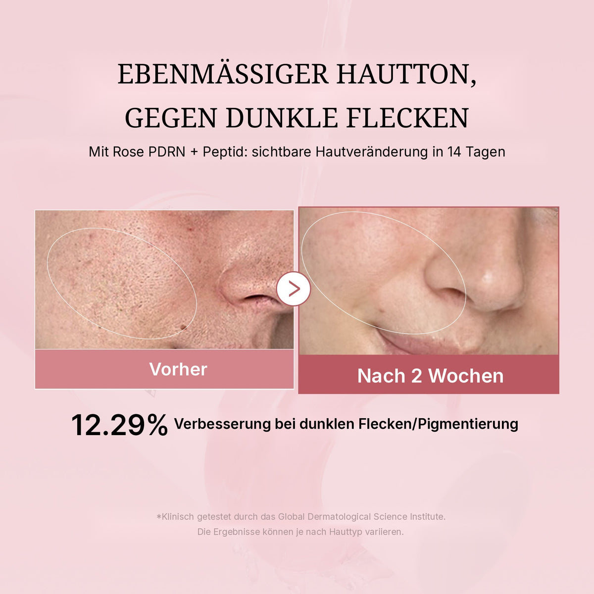 PDRN Pink Peptid Toner