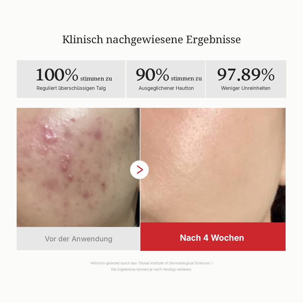 Red Bernsteinsäure Panthenol Pads