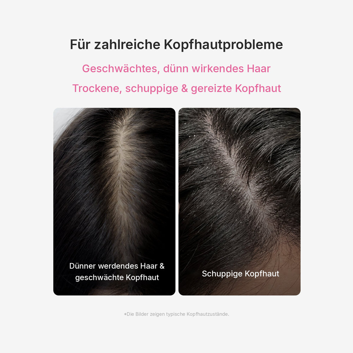Rosmarin PDRN Kopfhaut-Serum