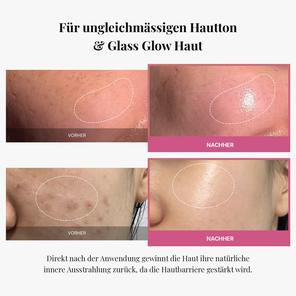 [Tati's Exclusive] Plump Perfection Set