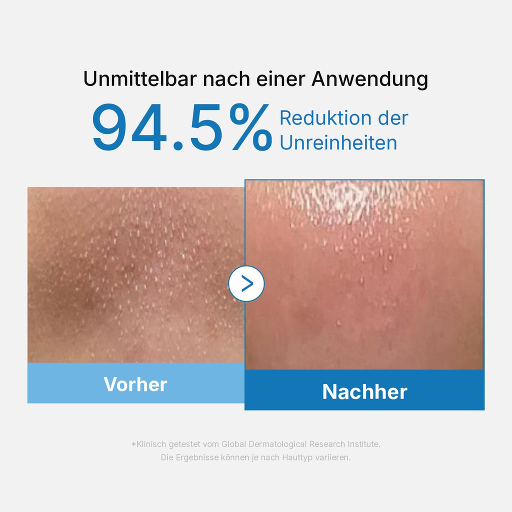 Zero Pore Mitesser Tiefenreinigungsöl